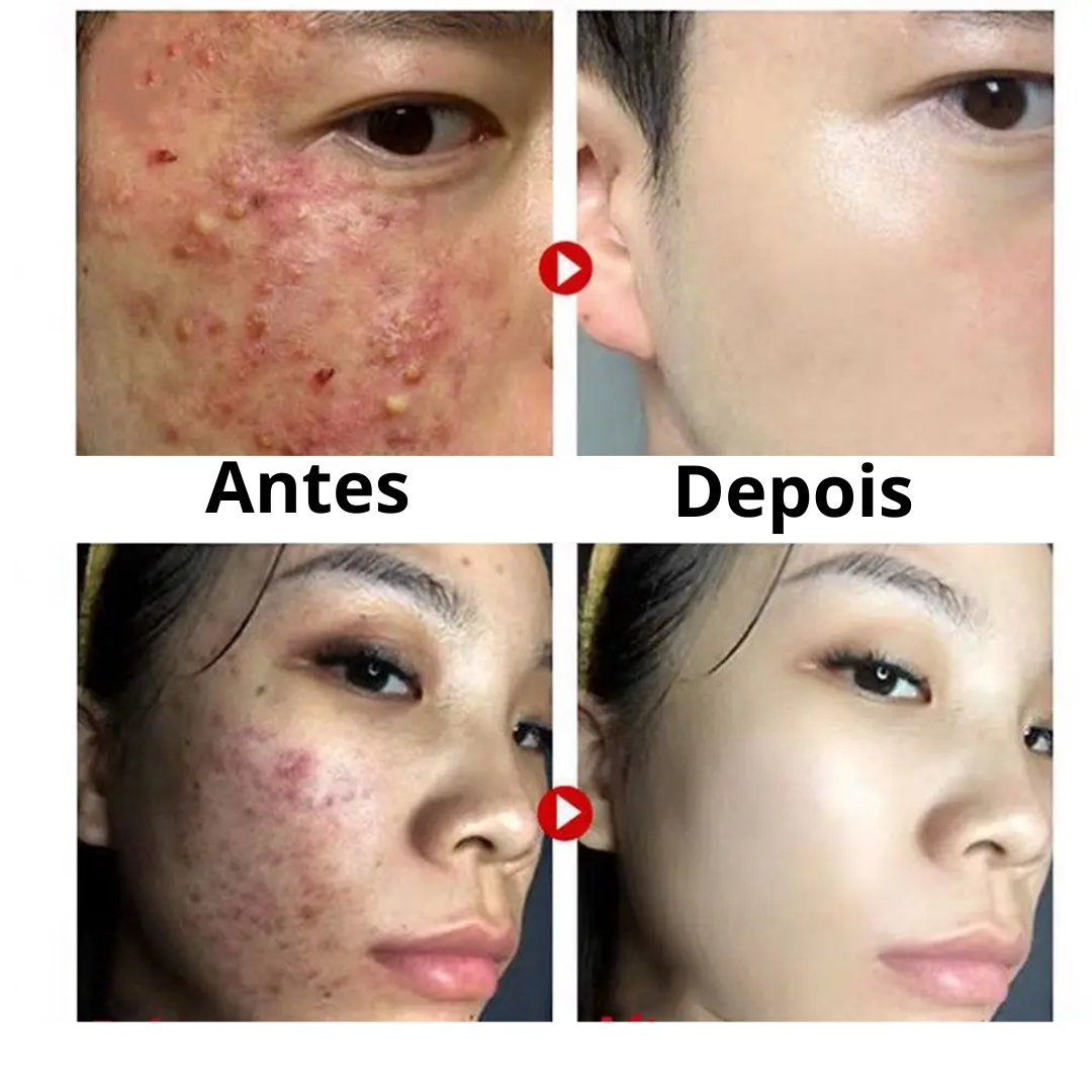 Máscara Facial Detox - Green Tea