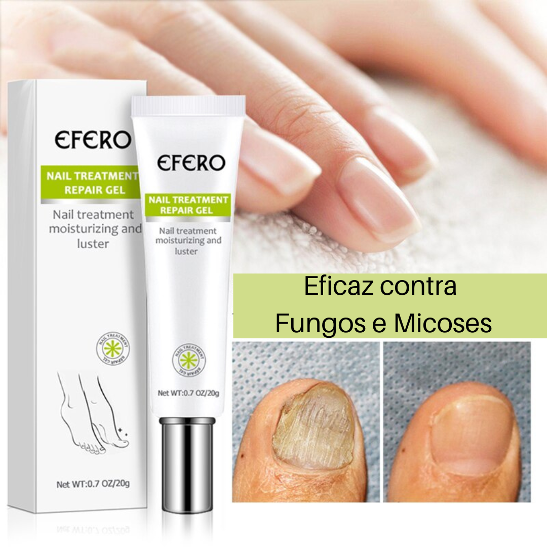 Efero Nails - Gel Anti - Fungos e Micoses™ - Festa do Desconto