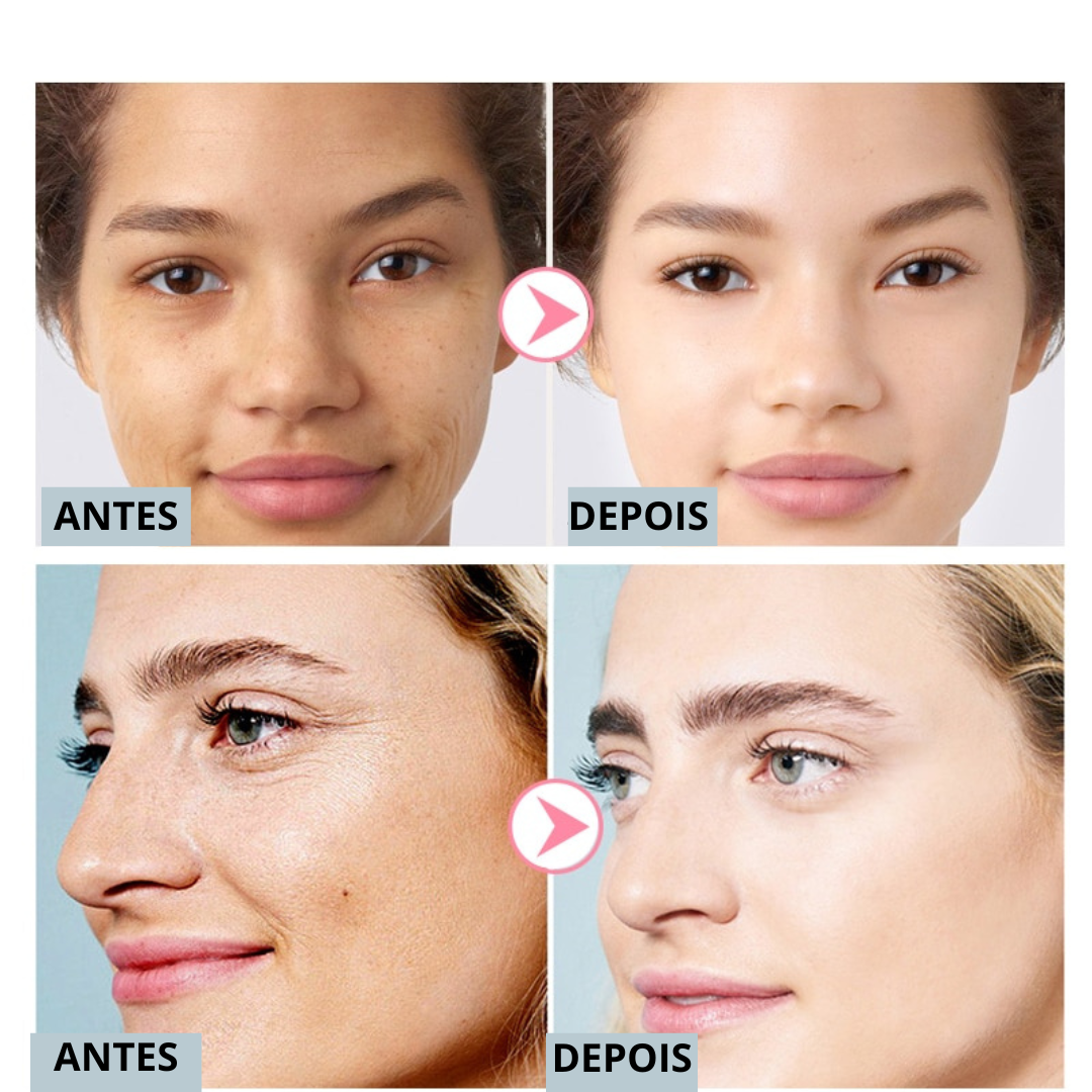 PUTIMI - Creme Rejuvenescedor FaceSlift [ÚLTIMAS UNIDADES] - Festa do Desconto