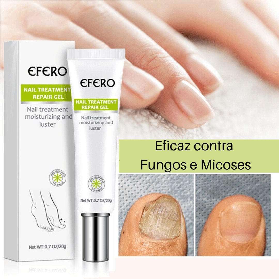 Efero Nails - Gel Anti - Fungos e Micoses - Festa do Desconto